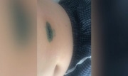Стрельба под Новомосковском: родственница раненого мальчика рассказала о его состоянии