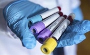 В Тульской области зафиксировано 88 новых случаев заболевания Covid-19
