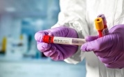 Иностранные студенты тульских вузов будут дважды сдавать тест на COVID-19