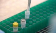 Вирусологи рассказали, когда начнется экспорт вакцины от COVID-19
