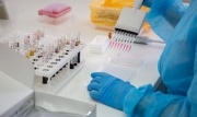 За ушедшие сутки 24 жителя Тульской области заболели коронавирусом