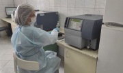 Чаще всего туляки заражаются ВИЧ после 30 лет