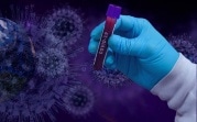 В Тульской области зафиксировано 82 новых случая заболевания Covid-19