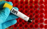 В Тульской области проживает около 7000 ВИЧ-инфицированных жителей