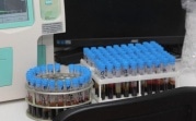 В Тульской области за сутки 33 новых случая коронавируса