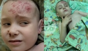 В «Золотом городе» на ребенка рухнула скульптура: дело скоро направят в суд